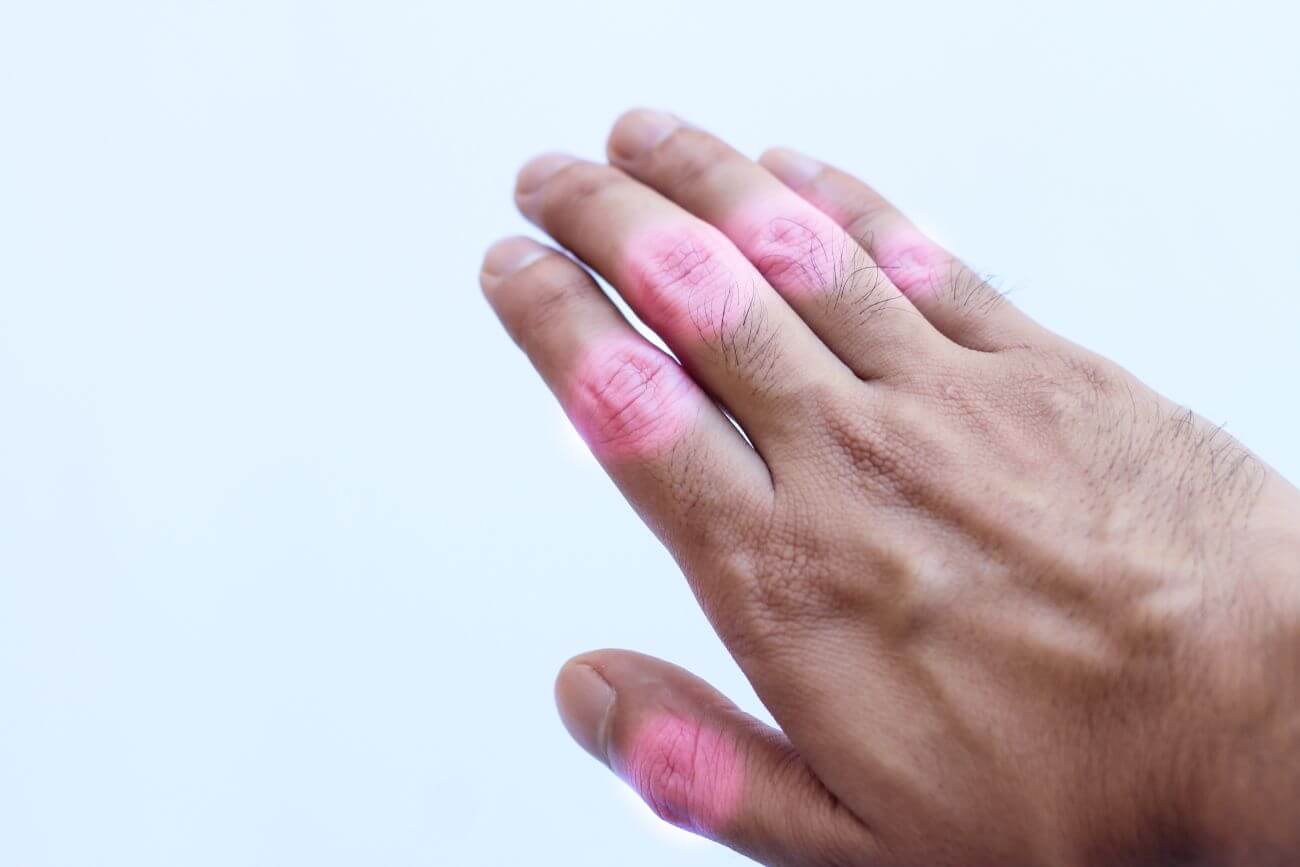 Bóle reumatyczne stawów – jak im zaradzić?