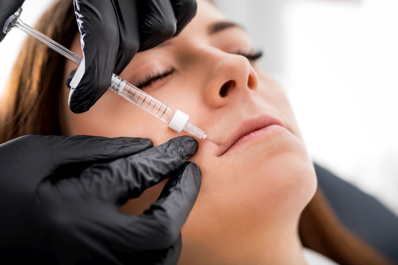 Powiększanie ust Teosyal Kiss – europejskie podejście do perfekcji